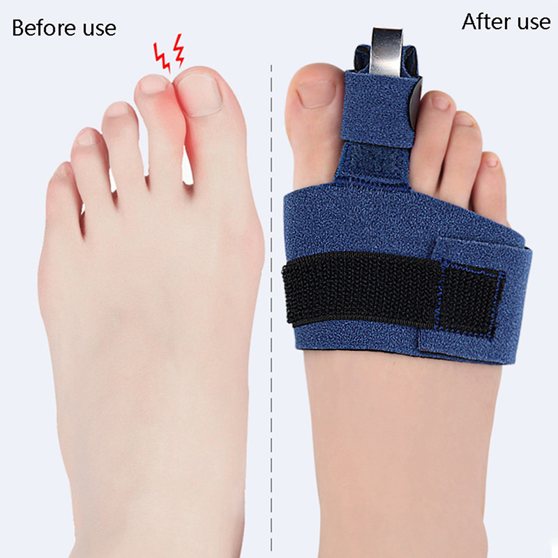 1 pièce Correcteur d'orteils,  - Ankle Brace Sock avis et prix